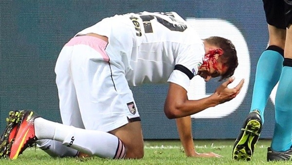Inter maçında kanlar içinde yerde kaldı