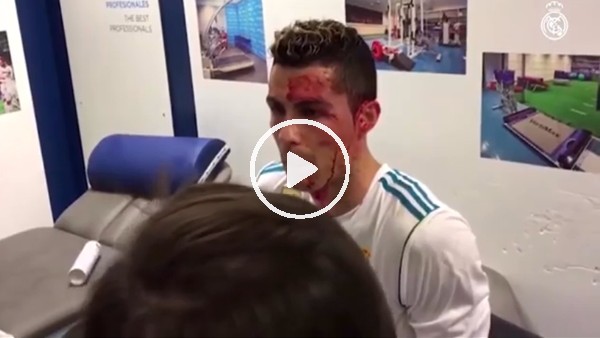 Ronaldo'nun kanlar içindeki görüntüleri yayınlandı!